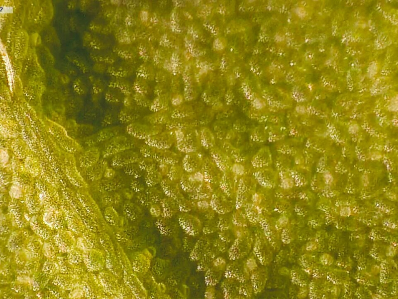 Bacterias